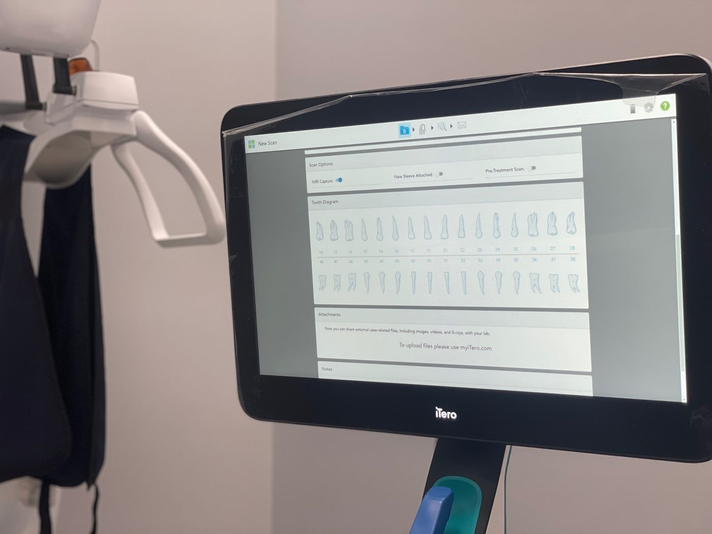 Digital iTero Scanner